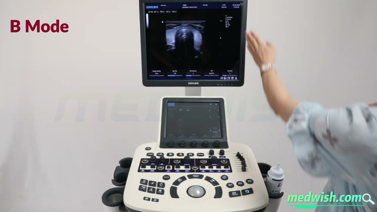 How to Operate Color Doppler Ultrasound Machines?