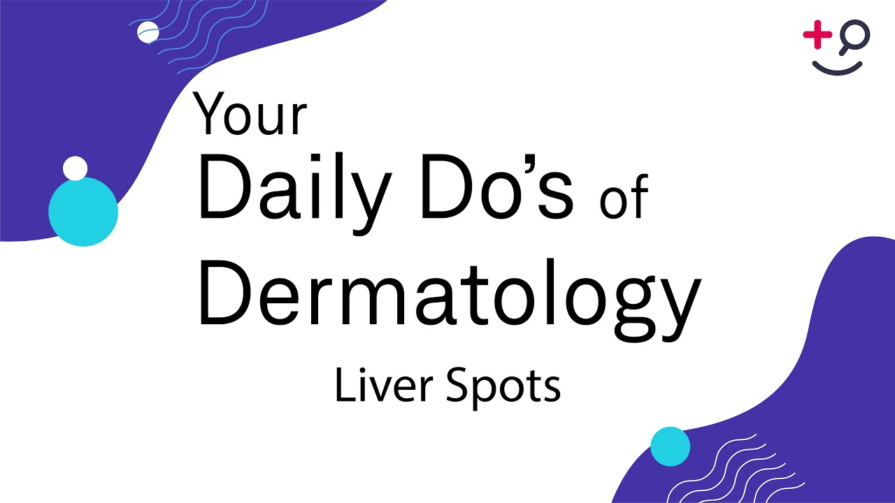 Liver Spots - Daily Do's of Dermatology
