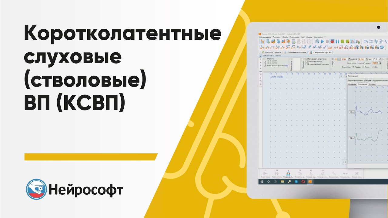 Коротколатентные слуховые (стволовые) вызванные потенциалы (КСВП)