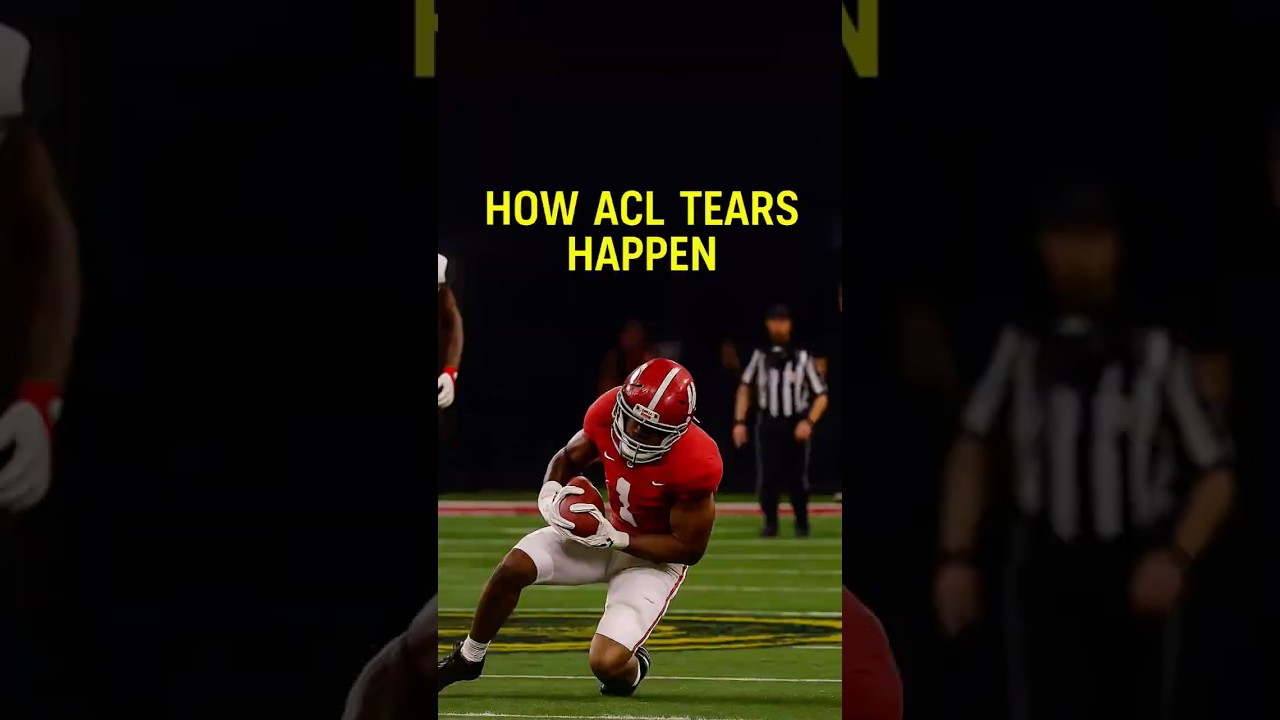 How ACL Tears Really Happen 🦵 | Sports Injury Explained