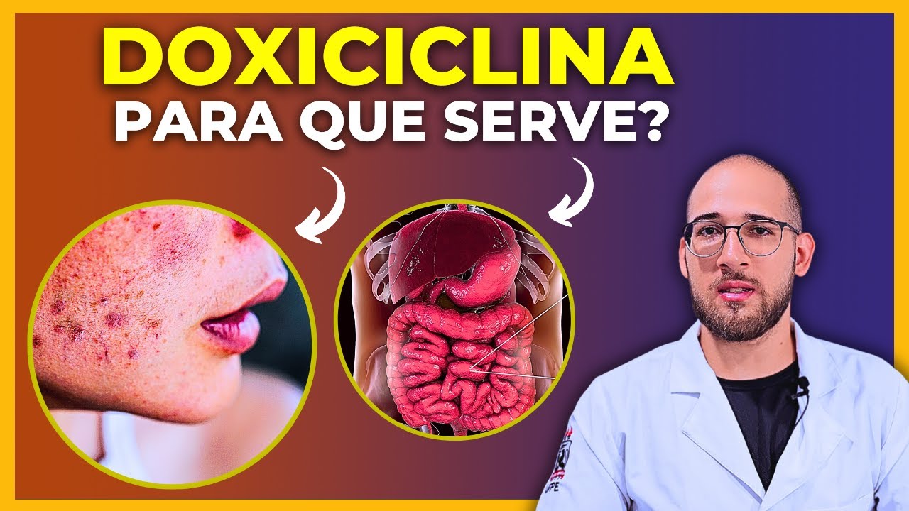 DOXICICLINA - Para que serve? Efeitos colaterais? Contraindicações? Tudo sobre esse antibiótico!