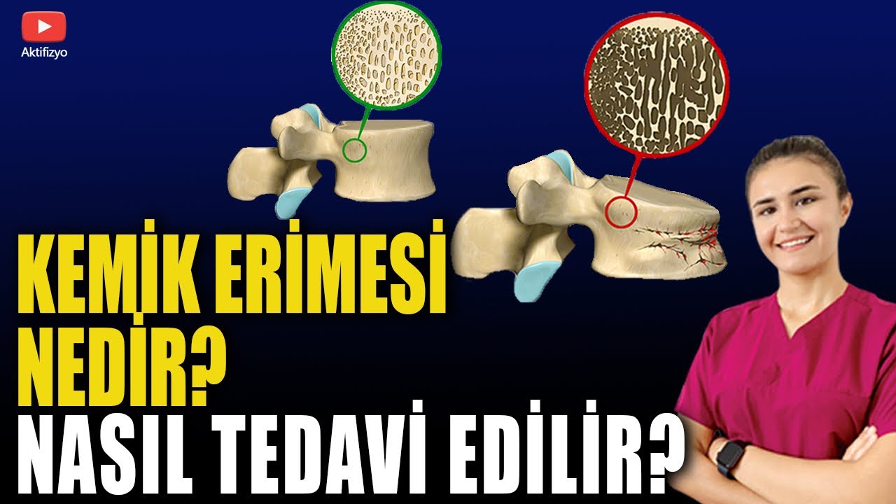 KEMİK ERİMESİ NEDİR? #aktifizyo #osteoporoz #kemikerimesi #kemikyoğunluğu