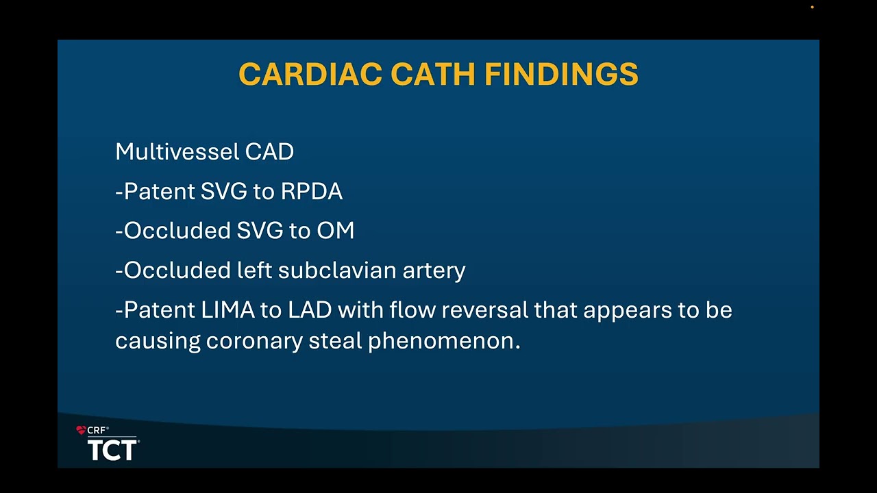 Left Subclavian Artery CTO Intervention to treat Coronary and Subclavian Steal