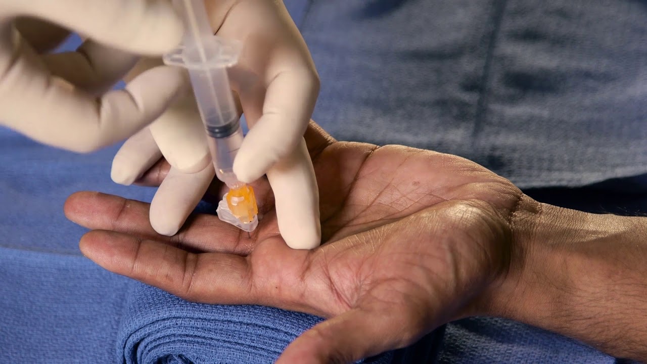 Блокады периферических нервов при операциях на кисти | NEJM