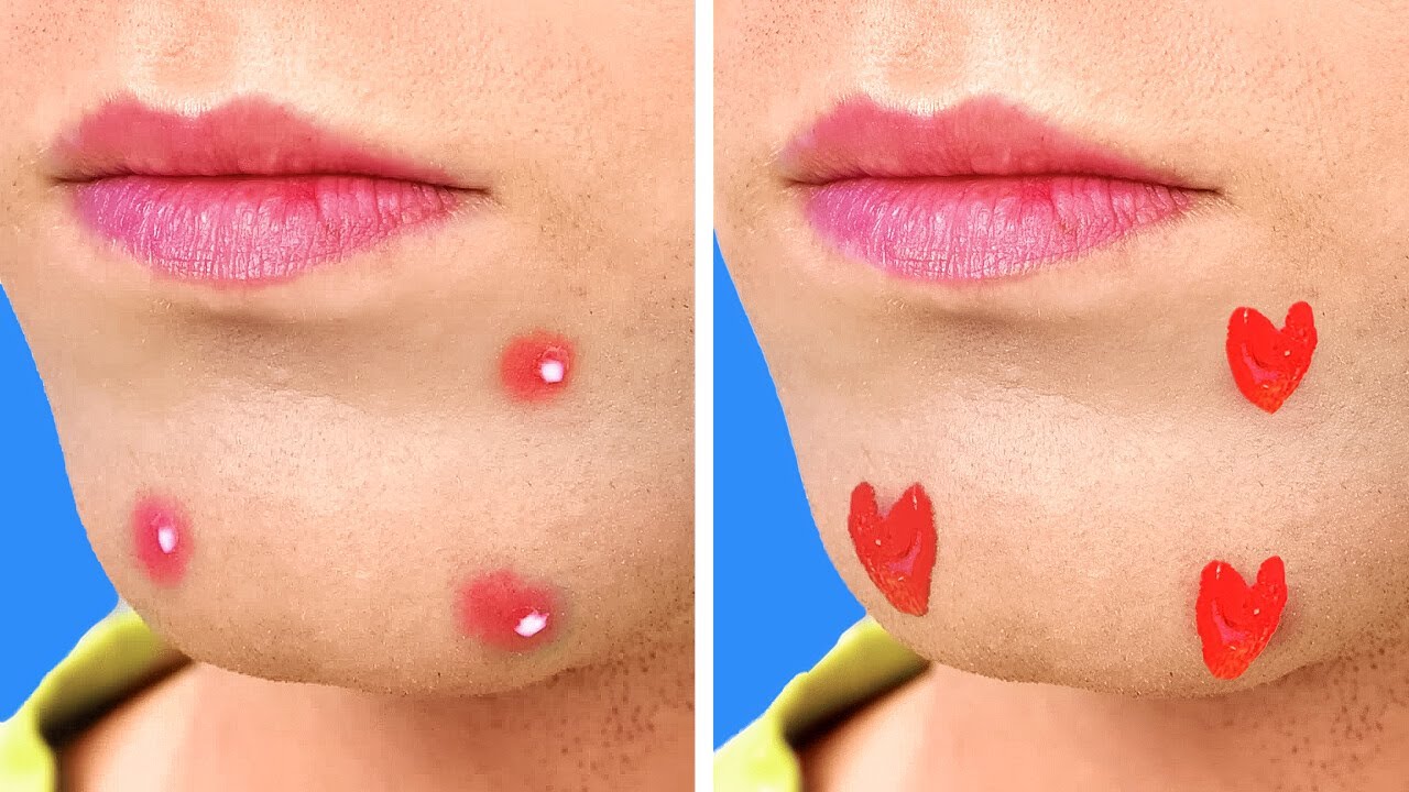 Cover your PIMPLES! 🔴 And fix another unpleasant problems