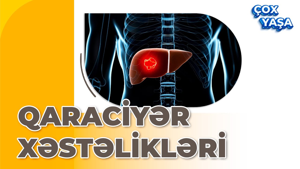 QARACİYƏR XƏSTƏLİYİ / QARACİYƏR YAĞLANMASI-ÇOX YAŞA.