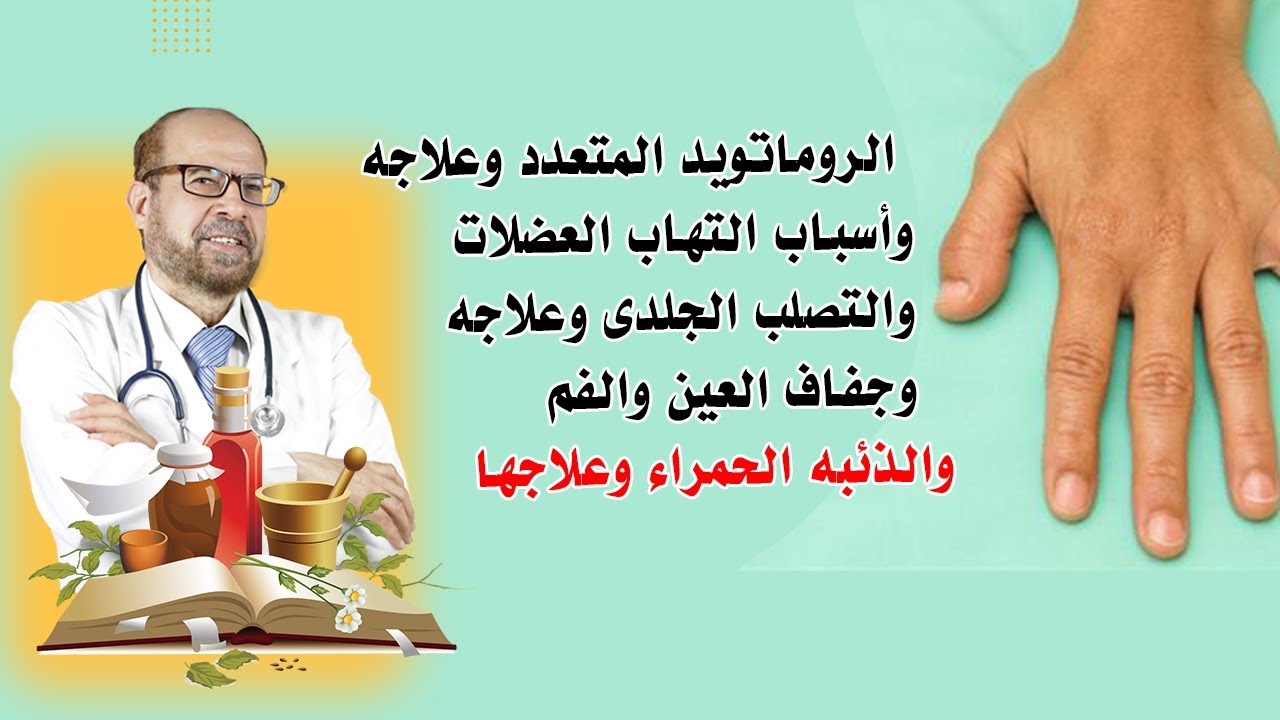 الروماتويد المتعدد وعلاجه☘️ أسباب التهاب العضلات☘️والتصلب الجلدى☘️ وعلاجه☘️وجفاف العين والفم