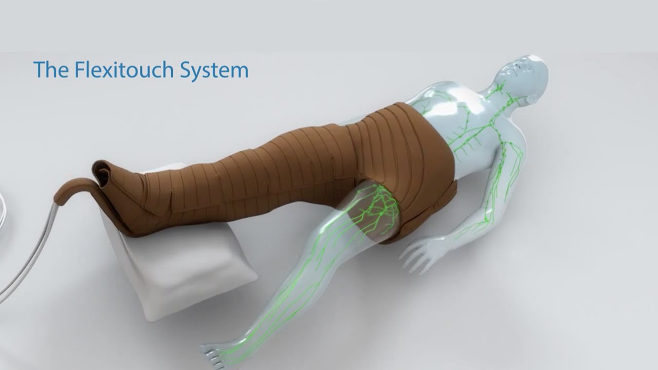 Лечение лимфедемы — лимфедемный насос Flexitouch System