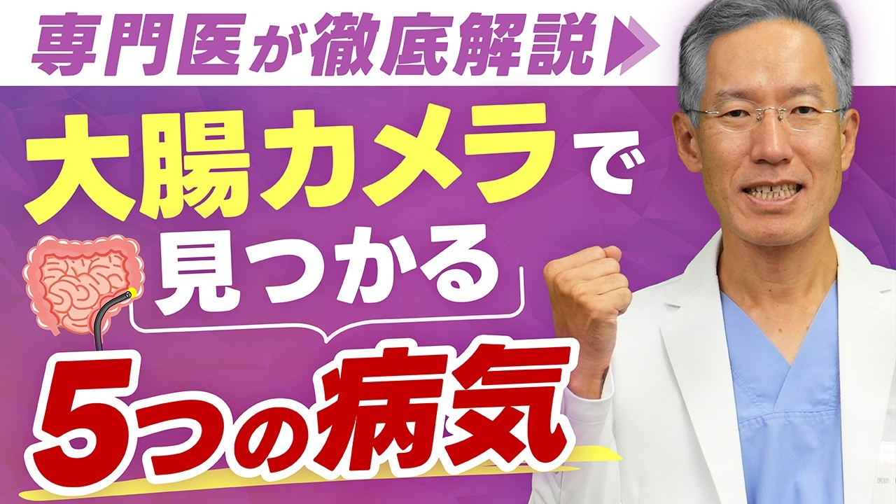 【大腸カメラ】検査で見つかる5つの病気とは？専門医が徹底解説