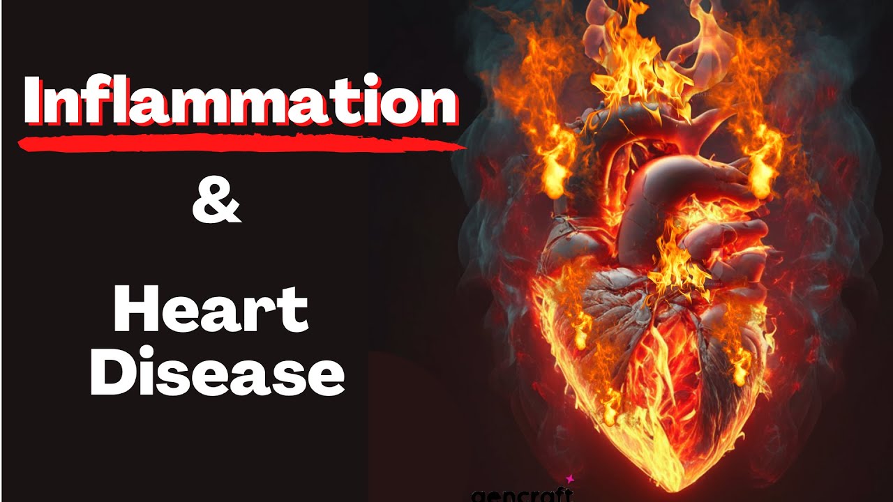 Is Inflammation the 