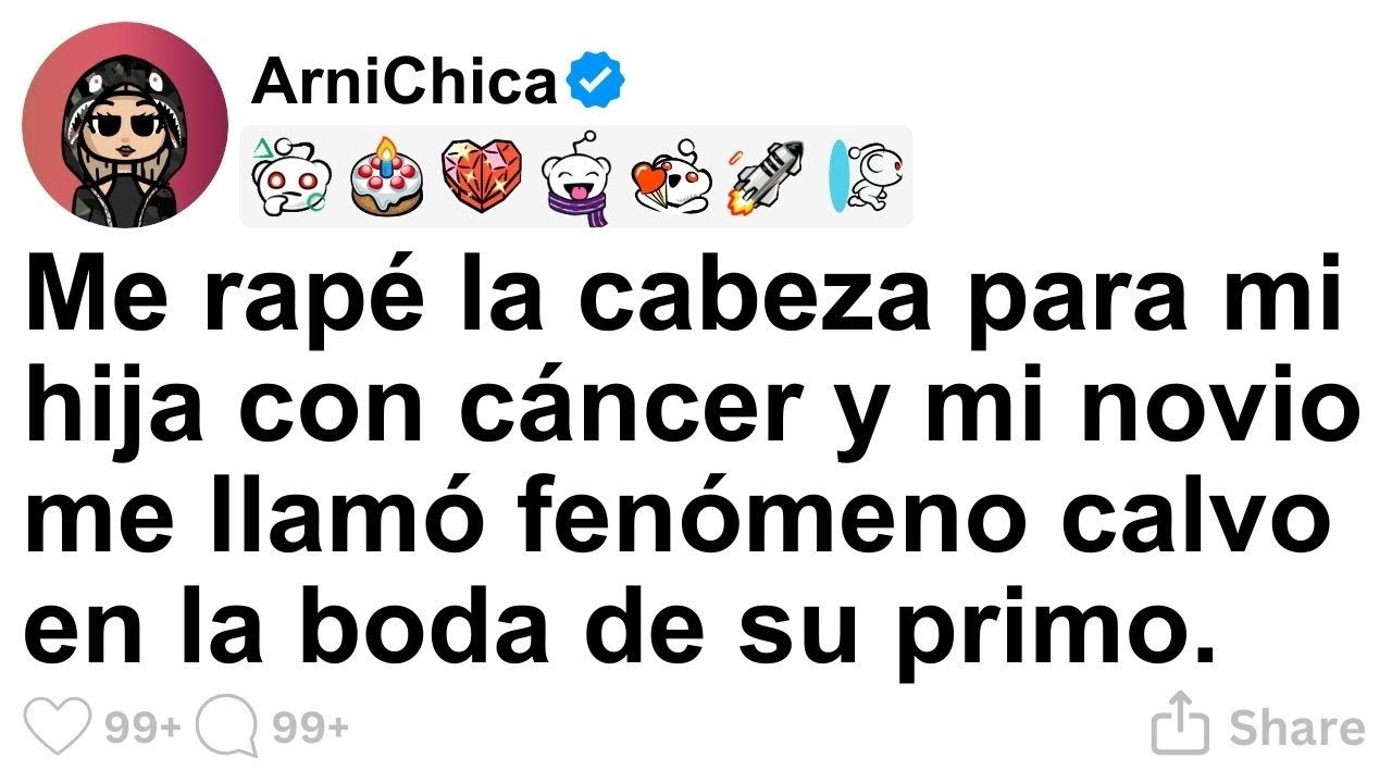 [TODA LA HISTORIA] Me rapé la cabeza por mi hija, pero mi novio me llamó freak.