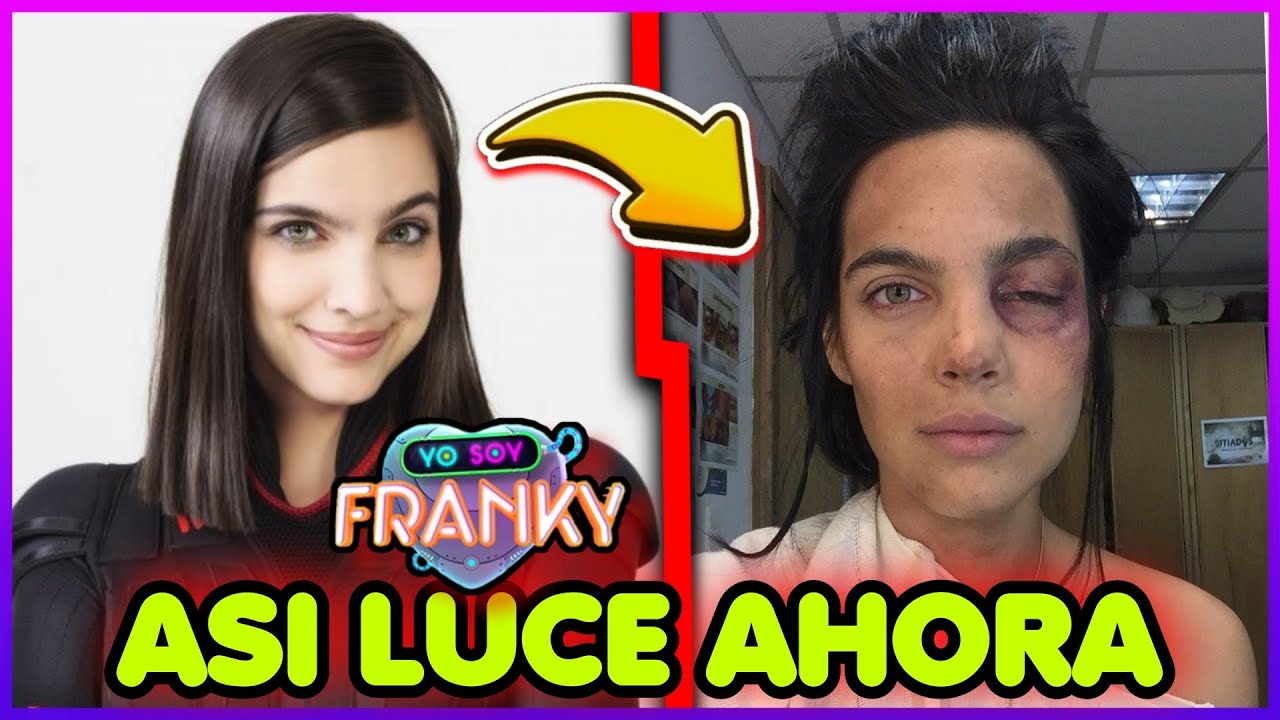 YO SOY FRANKY ANTES Y DESPUES 2021 |  ASI LUCEN EN LA ACTUALIDAD