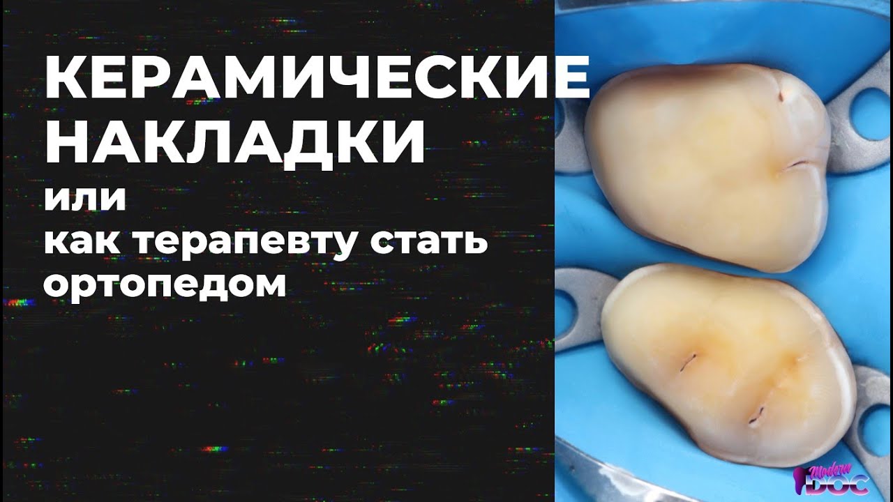 КЕРАМИЧЕСКИЕ НАКЛАДКИ ИЛИ КАК ТЕРАПЕВТУ СТАТЬ ОРТОПЕДОМ 1часть