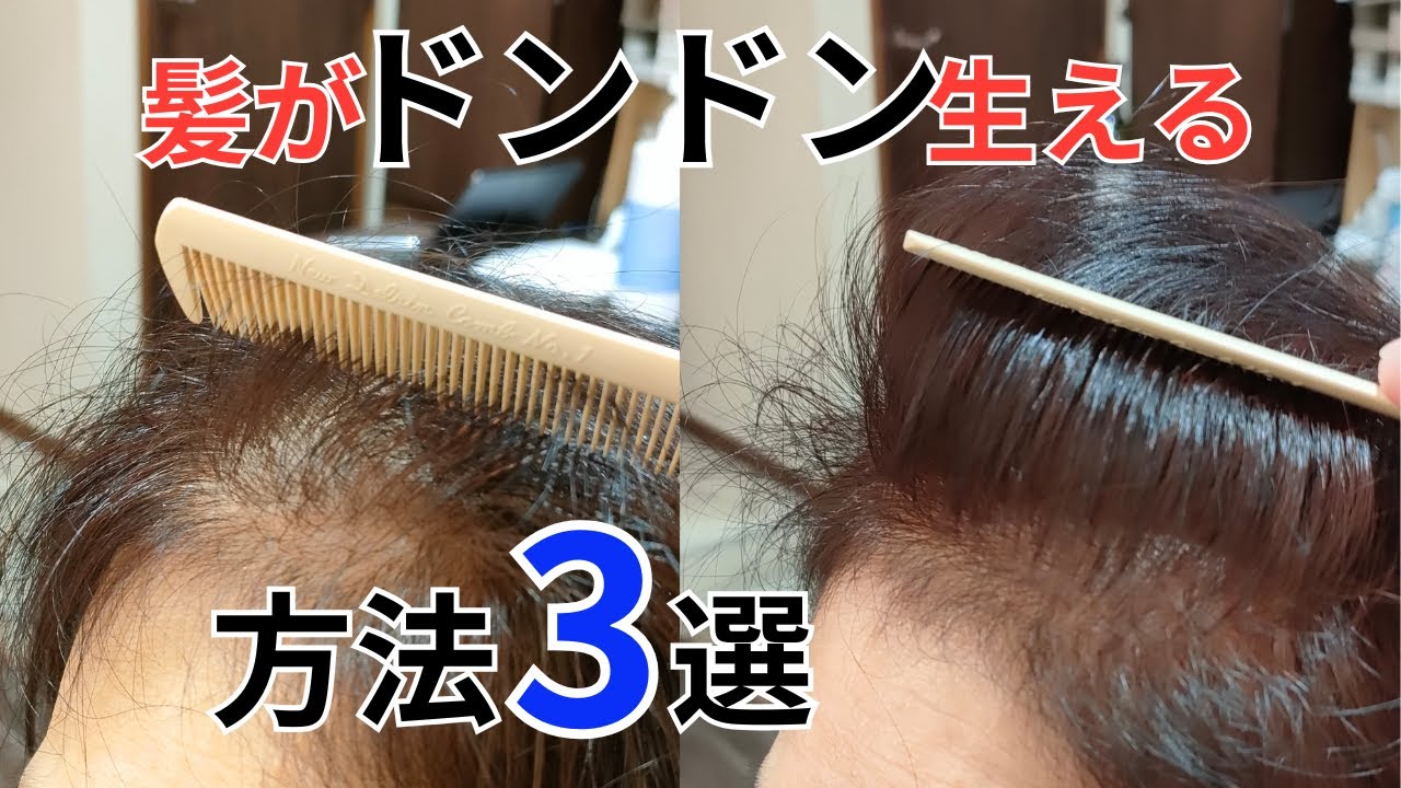 「薬に頼らず髪が増える！抜け毛対策3選｜ふんわりボリュームアップの方法」/品川区中延美容室Pensiero【ペンシエロ】