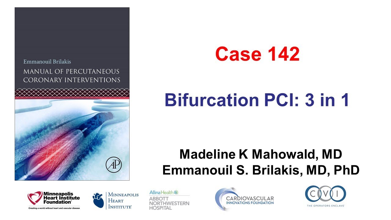 Case 142: PCI Manual - Bifurcation PCI: three in one