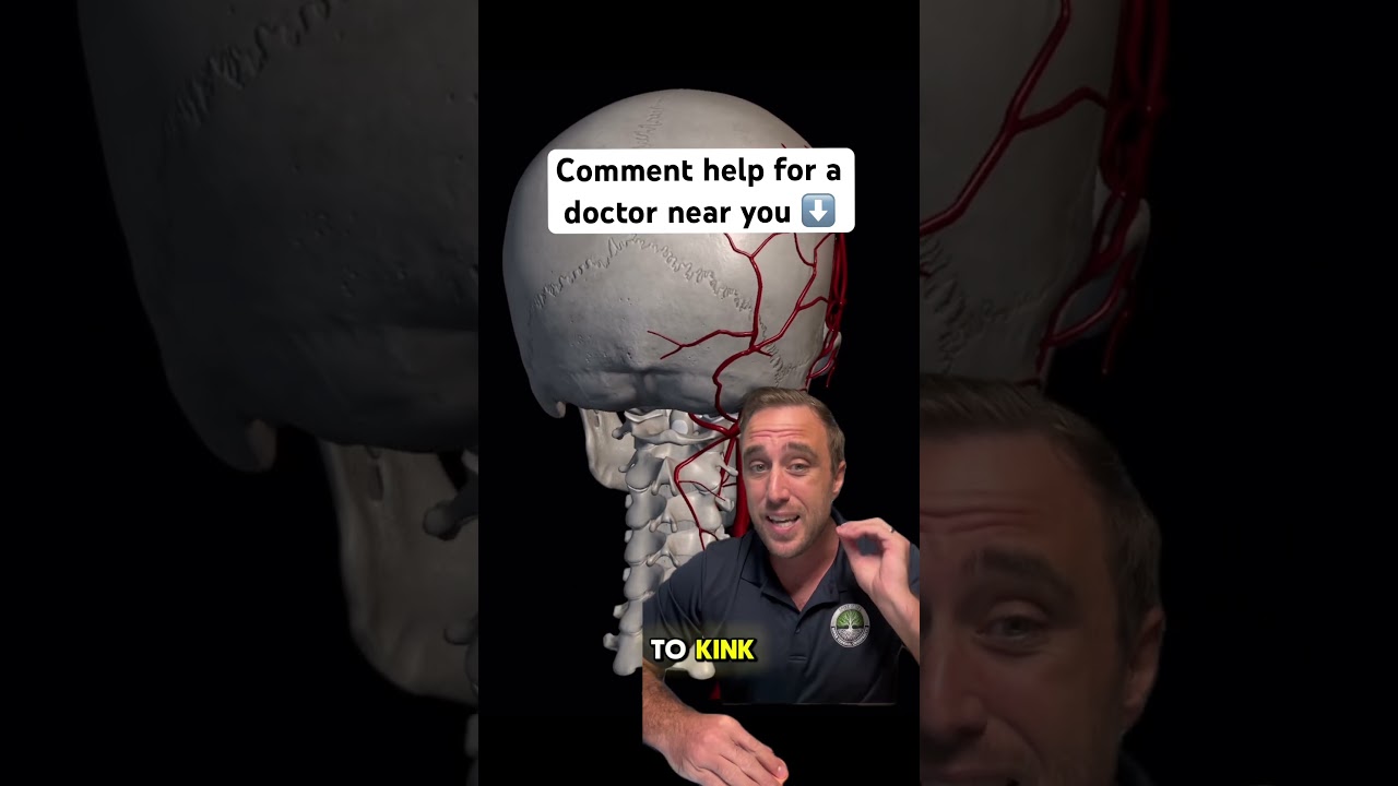 Craniocervical instability and how to resolve symtoms! #dizziness #migraine #fyp #uppercervical