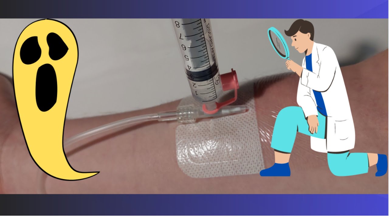 Катетеризація периферичної вени. ( Catheterization of a peripheral vein.