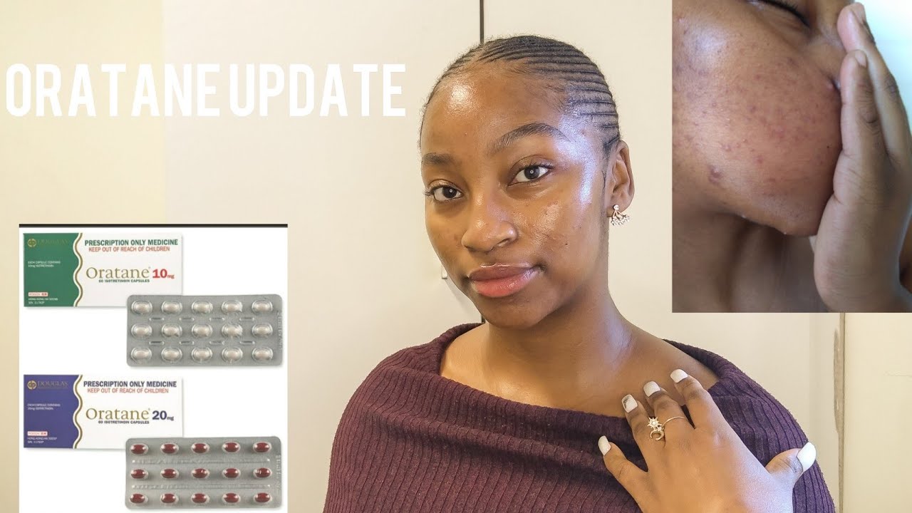 ORATANE UPDATE #1 PLAN, SIDE EFFECTS-Dermatologically approved routine that helped clear my skin