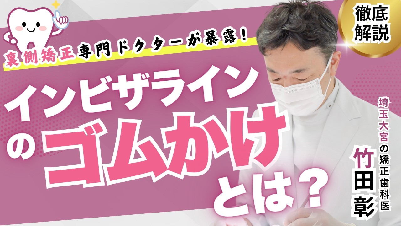 インビザラインでゴムかけは必要？目立つ？仕組みや自己管理を解説