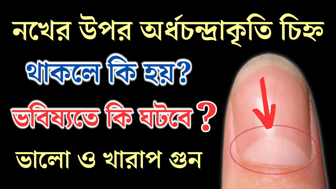 অর্ধচন্দ্রাকৃতি চিহ্ন বা নখে সাদা দাগ থাকলে কি হয় || তার সাথে ভবিষ্যতে কি ঘটবে