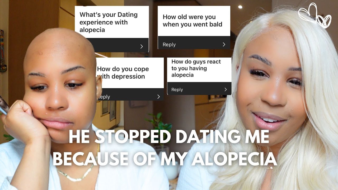 Chit Chat GRWM: Dating with Alopecia is Hard | How to gain confidence with a bald head | Juicyyy Q&A