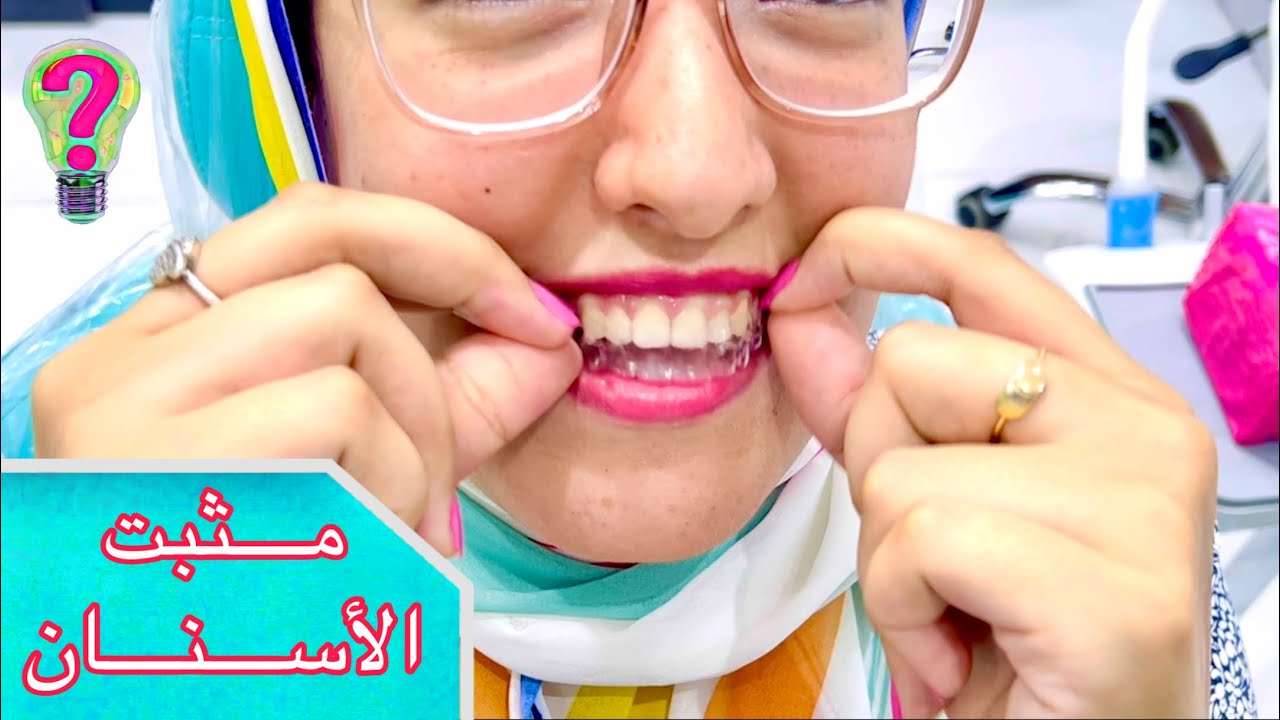 هام جدا | مثبت الأسنان الشفاف بعد تقويم الأسنان | تعليمات ضرورية RETAINER