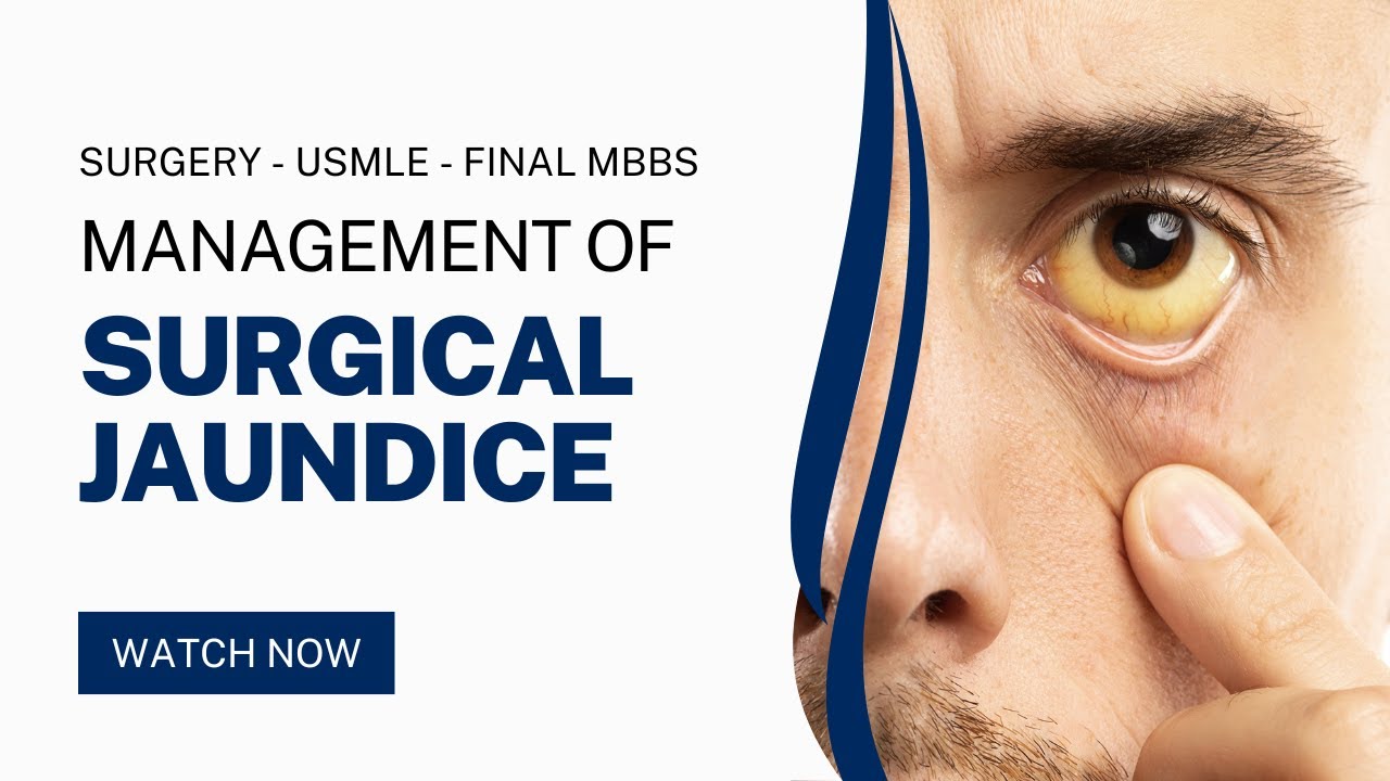 Management of Surgical Jaundice - Basic Principles for USMLE Final MBBS