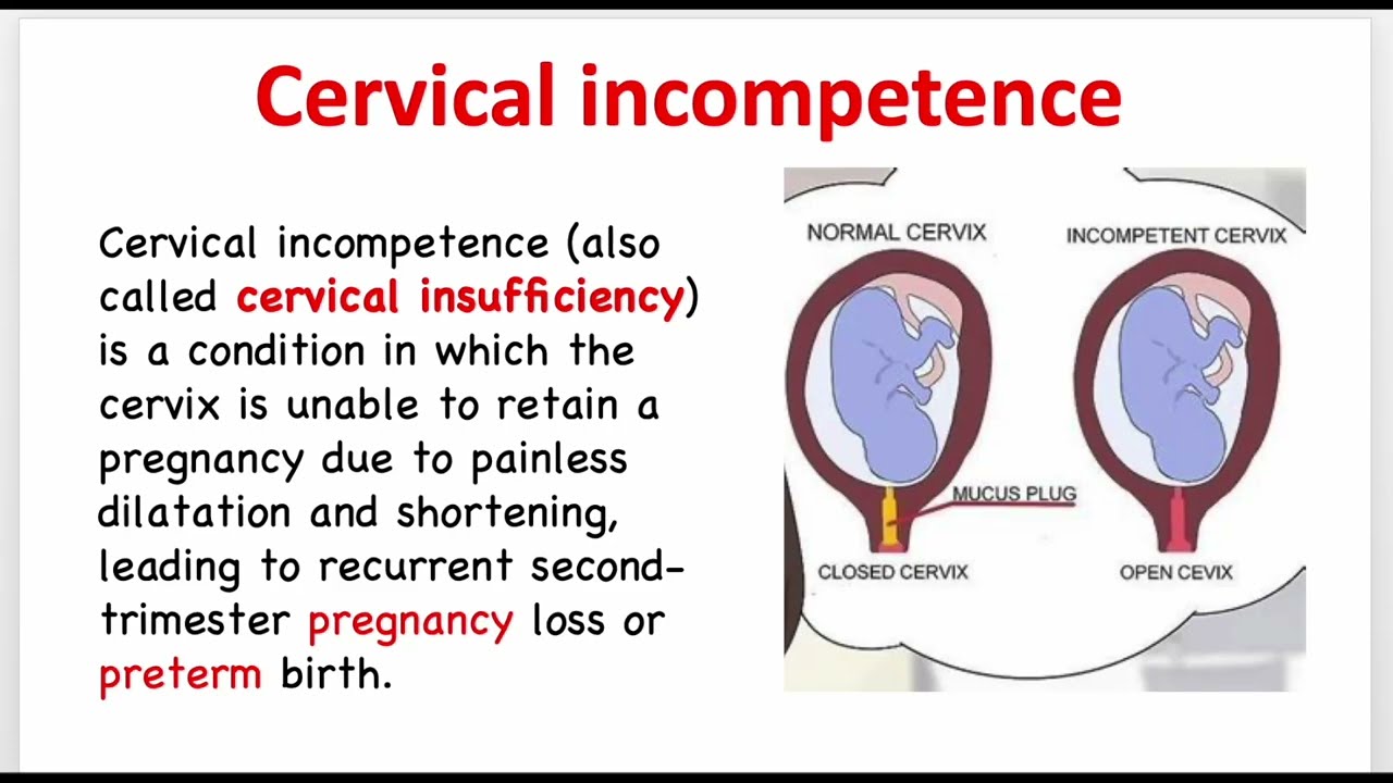 Cervical incompetence