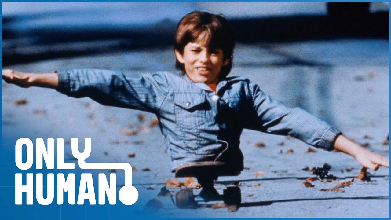 Человек с половиной тела ходит на руках: Кенни Истердей (Необыкновенные люди) | Только человек