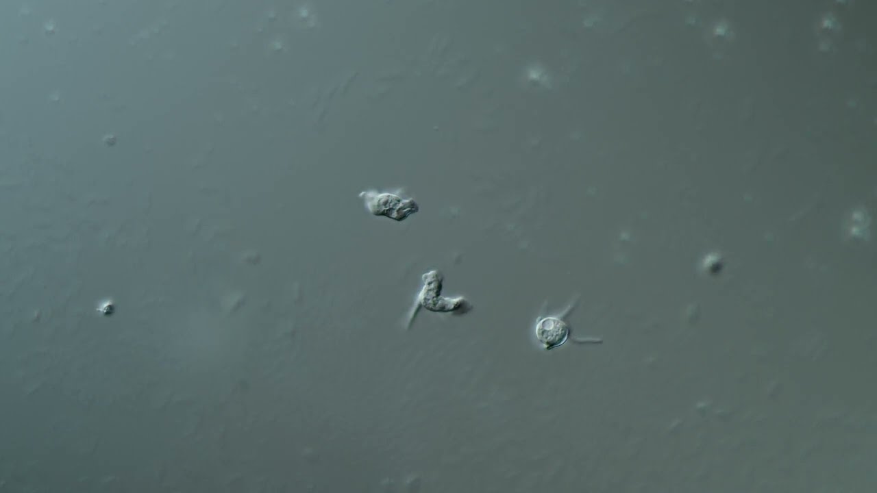 Amoeboids (?)