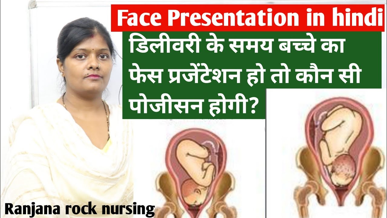 Face presentation lecture in hindi | lie, position & denominator | anterior, posterior and lateral