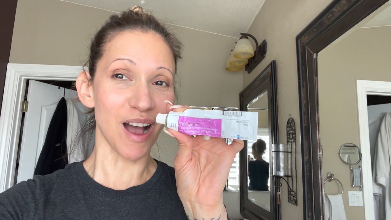 Healing my Melasma and sun damage with Tri-Luma #6 month update