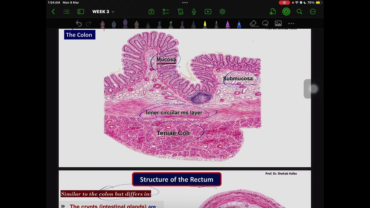 Histology of The large intestine  NMU 