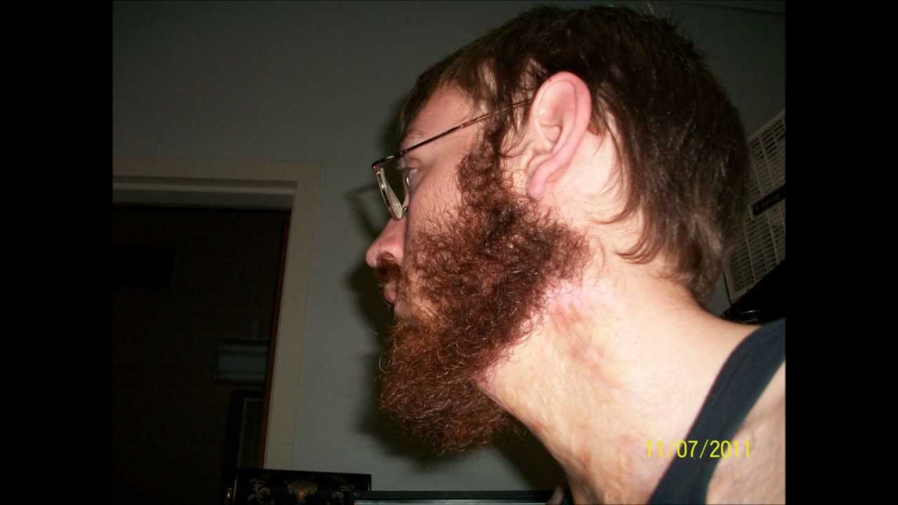 6 Month Beard Growth Time Lapse