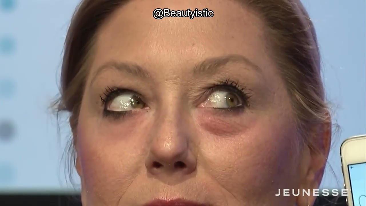 Instantly Ageless Review: Is This Eye Bag Remover Worth Your Investment?