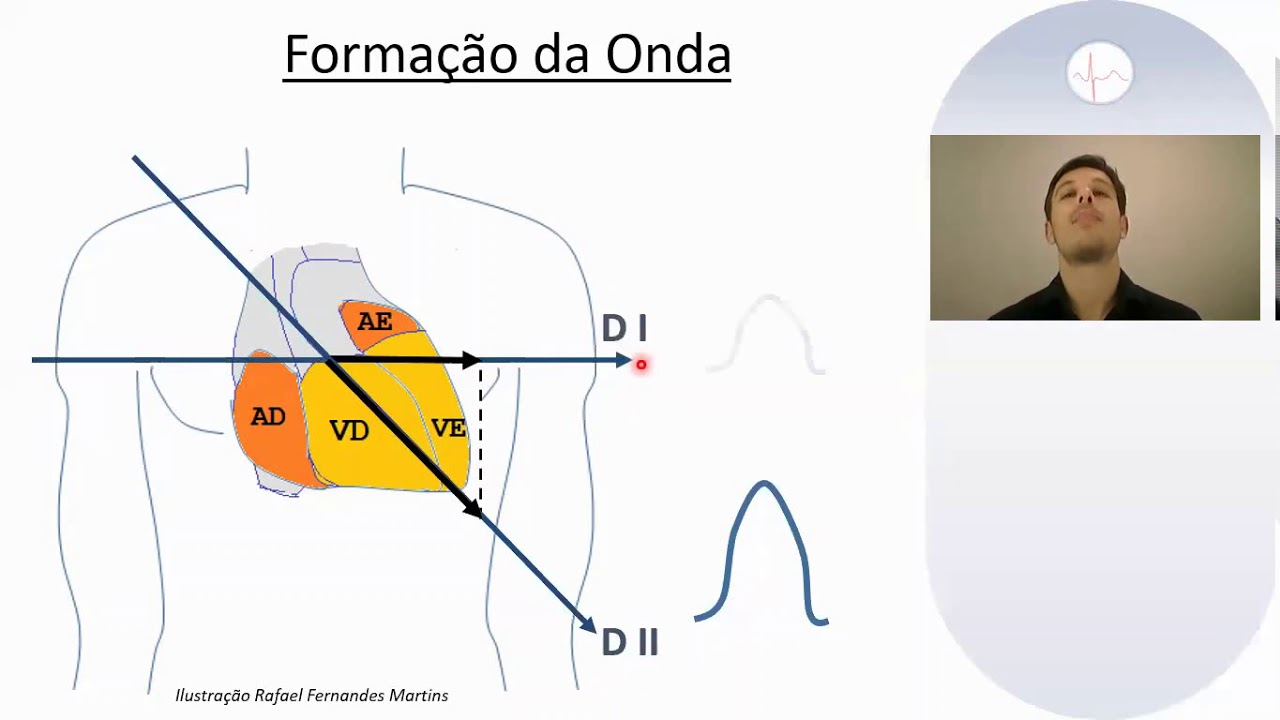 Descomplicando o ECG: 3 - Posição do coração, formação de onda