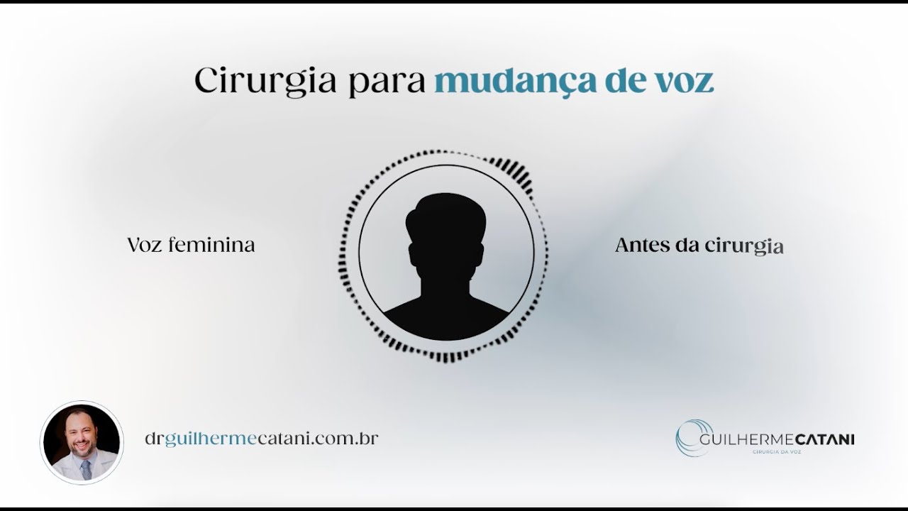 Cirurgia de Feminização Vocal - Mudança de Voz | Dr. Guilherme Catani