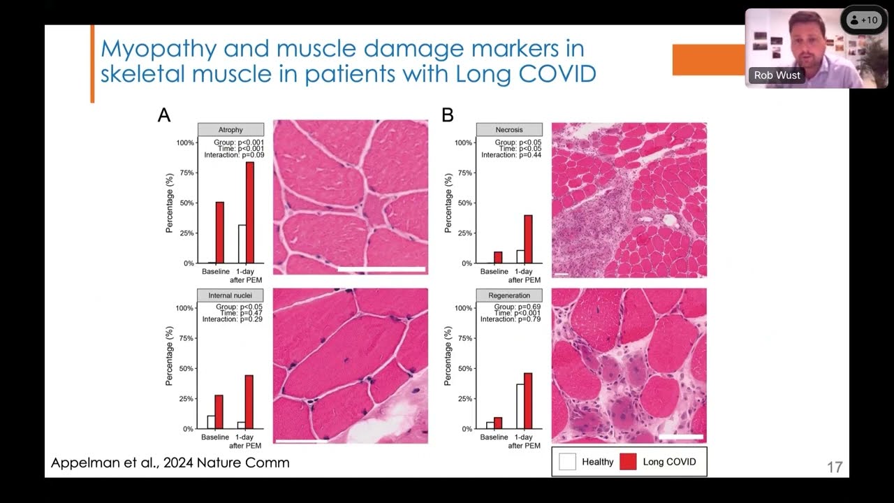 Dr. Rob Wüst: Muscle Function & Post-Exertional Malaise in Long COVID (Day 1, Block 2)