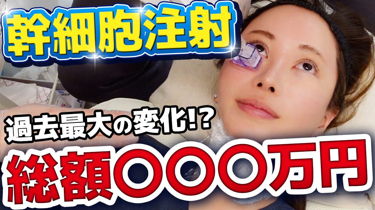 【話題の再生医療】幹細胞注射を体験して真相解明した。