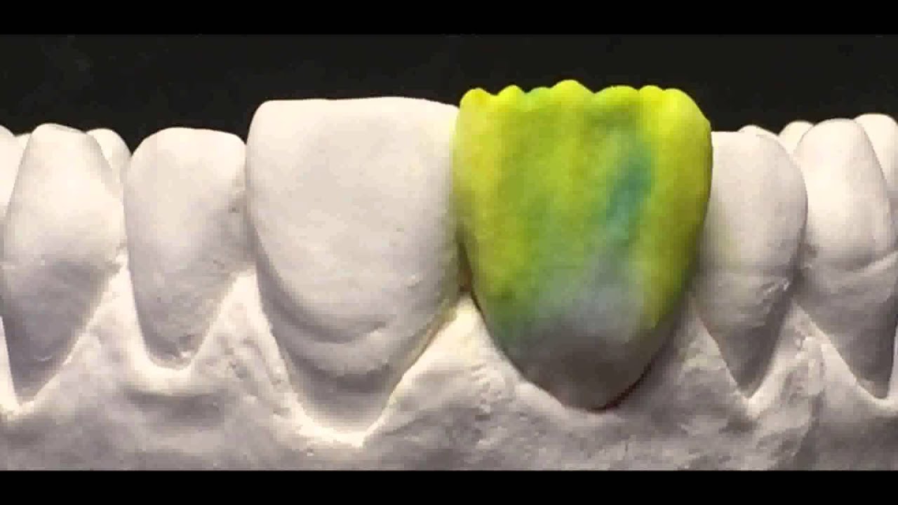 CZR Core&Shell - Step 3