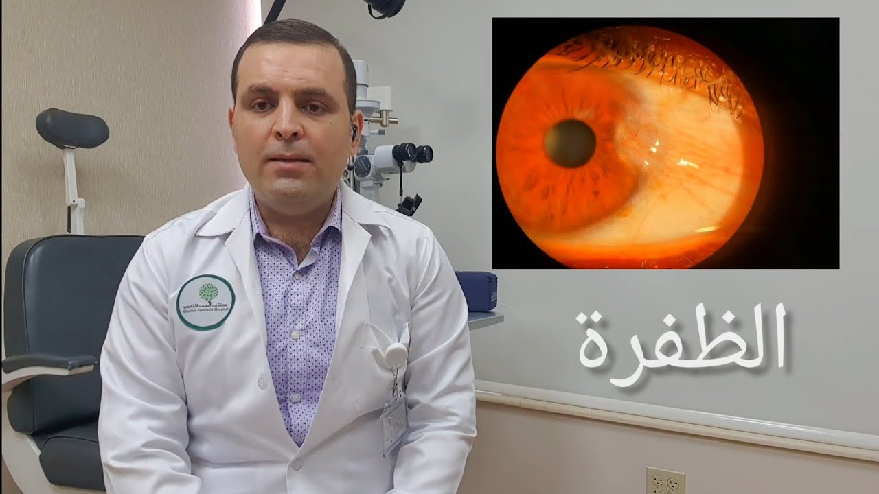 الظفرة (اللحمية) أسبابها وعلاجها.