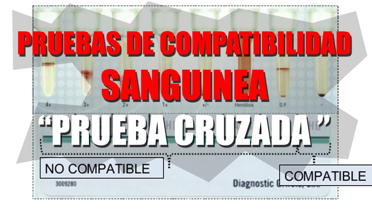Tutoria 4: Prueba De Compatibilidad Sanguínea Segunda Parte (Practica).