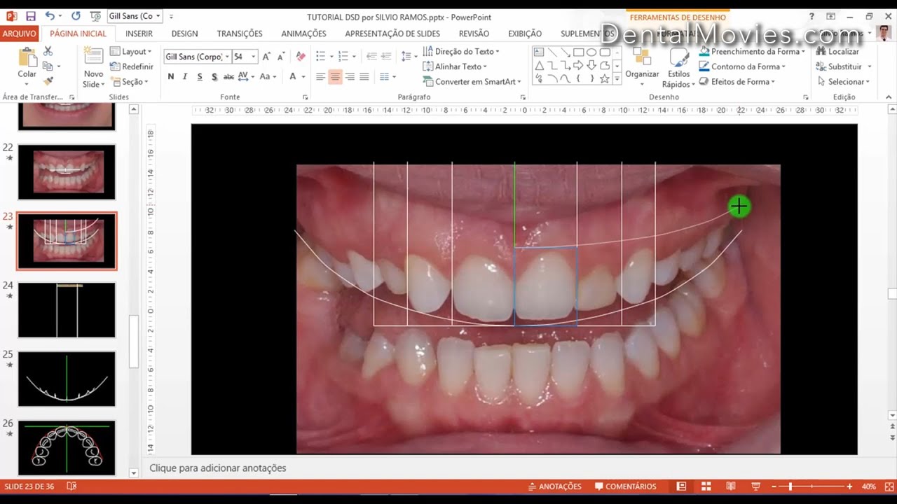Digital Smile Design - Christian Coachman & Livio Yoshinaga - PART 2/4
