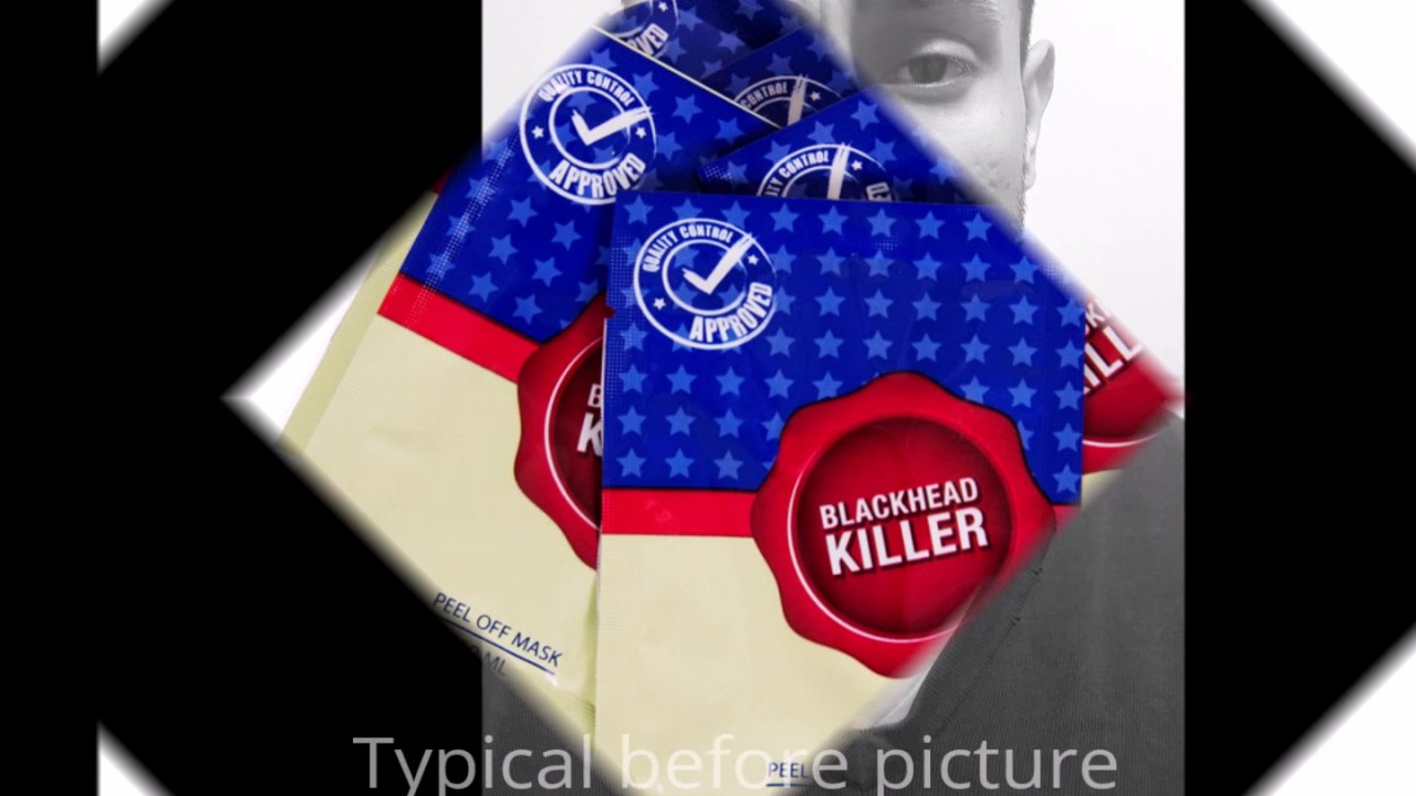 BlackHead Killer Face Mask Test