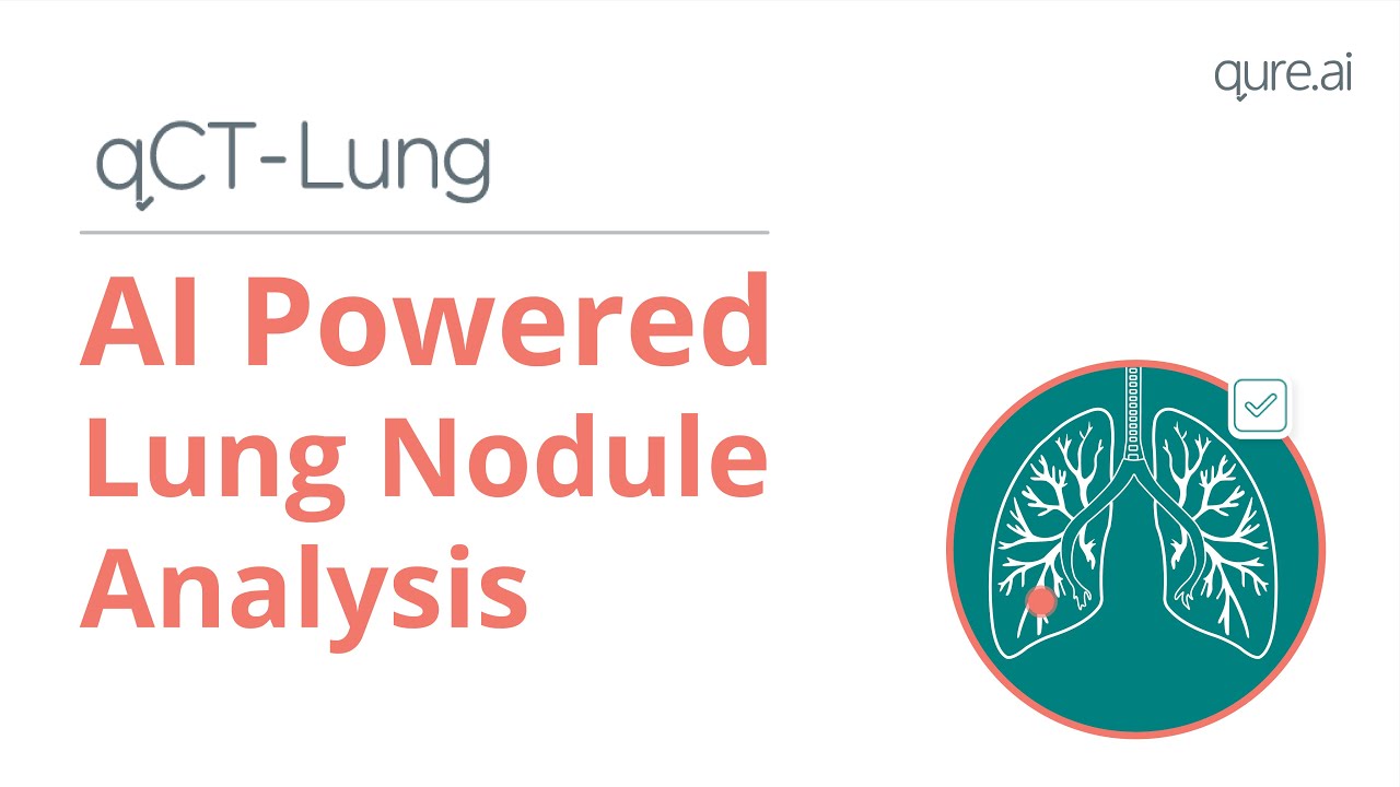 qCT-Lung - AI Powered Lung Nodule Analysis