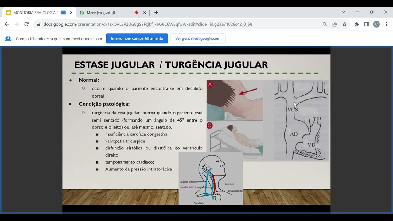 Turgência Jugular