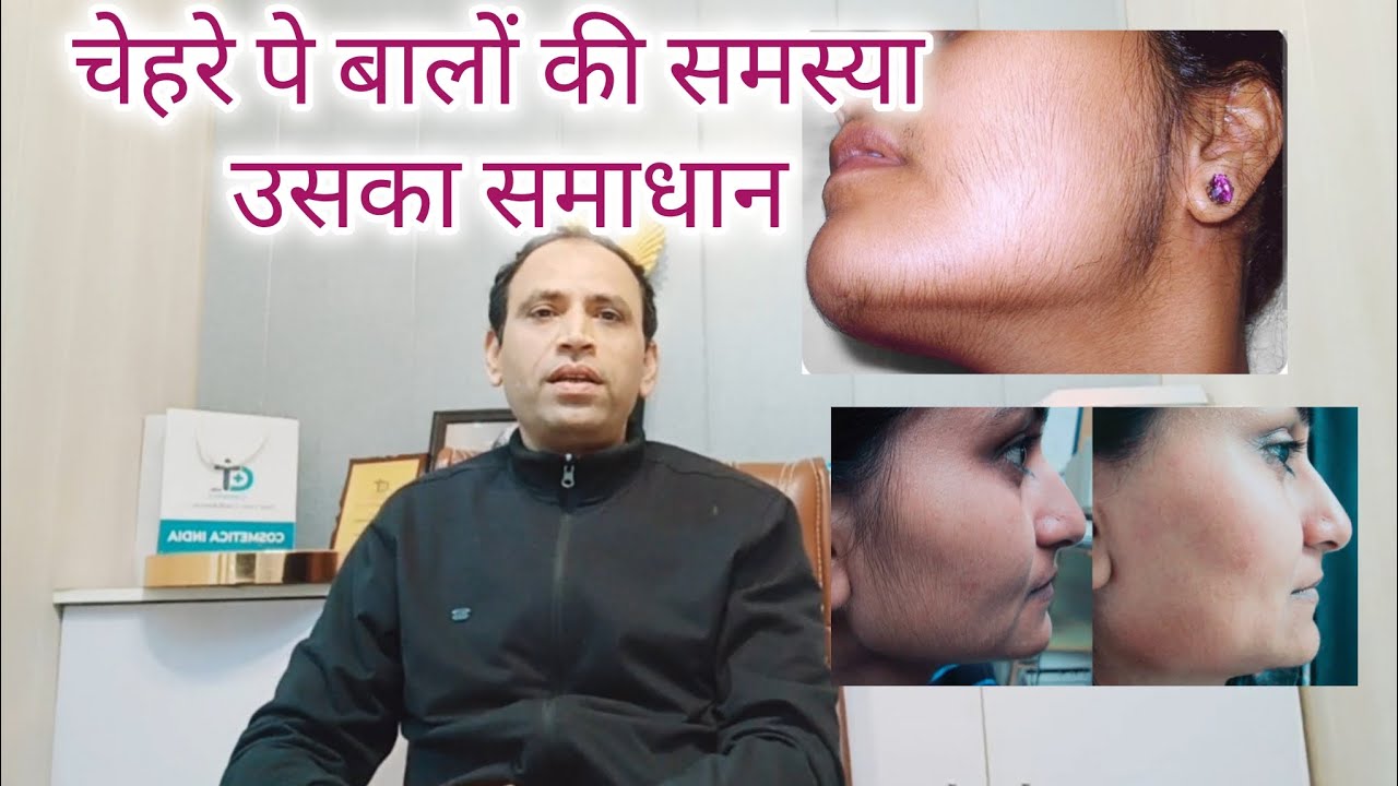 चेहरे पर बालों की समस्या उसका समाधान। Face hair removal solution 