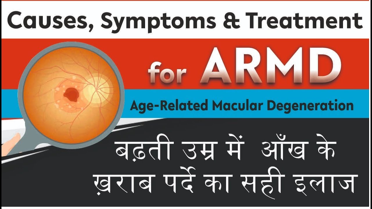 What is Age Related Macular Degeneration ? | AMD Treatment | बढ़ती उम्र में आँख के ख़राब पर्दे का इलाज