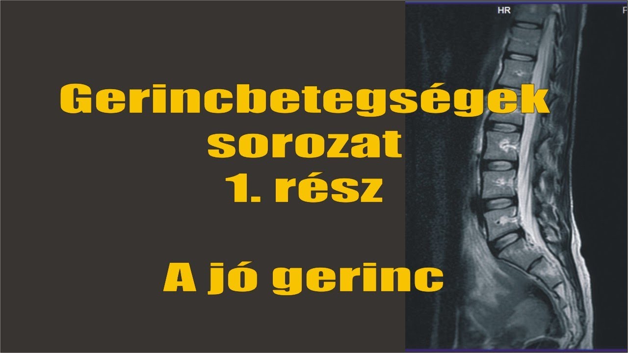 A gerincbetegs&eacute;gek sorozat 1. r&eacute;sz: A j&oacute; gerinc