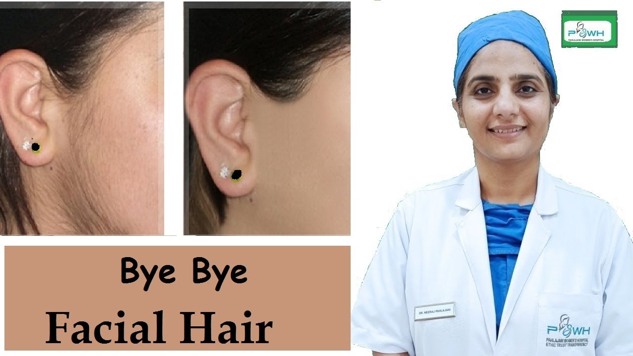 चेहरे के अनचाहे बालो से छुटकारा | Unwanted Facial Hair Growth in Female